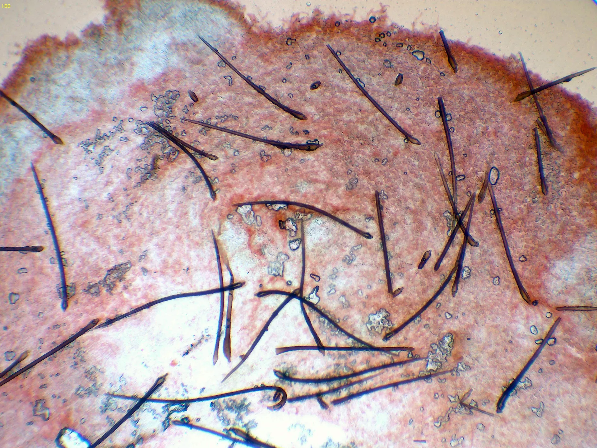 Microscopía de Marasmius hudsonii - 11 - Pelos x 100-001